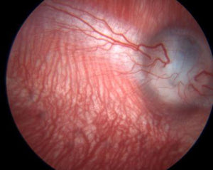 Color fundus iage of albino rabbit with vasculature and optic visual strip  fully illuminated